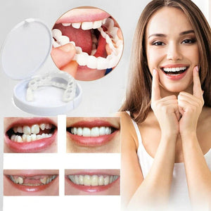 Carillas dentales Dentys- Vuelve a Sonreir con confianza